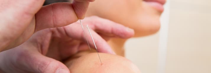 Dry Needling Dry Needling in Aiken SC